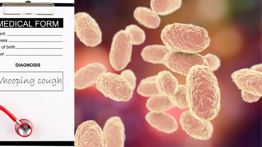 reasons of whooping cough